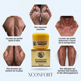 Fini les Démangeaisons : Crème Apaisante à Action Rapide