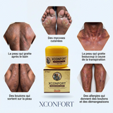 Fini les Démangeaisons : Crème Apaisante à Action Rapide